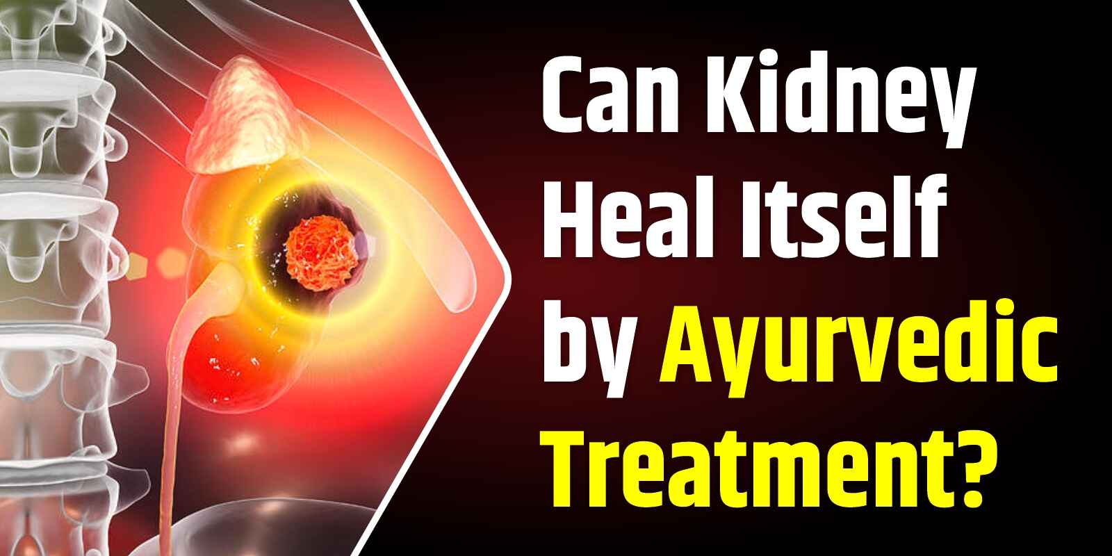 Ayurvedic Kidney Treatment